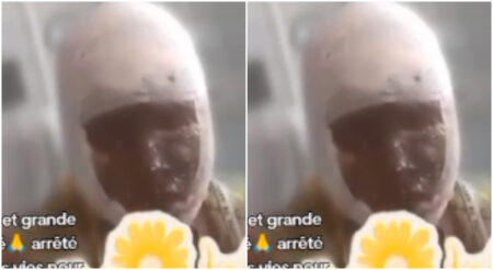 Jalousie mortelle : une femme verse de l’acide au visage de la compagne de son ex Jalousie mortelle : une femme verse de l'acide au visage de la compagne de son ex